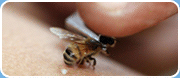 Апитерапия лечение пчелами на дому Петербург